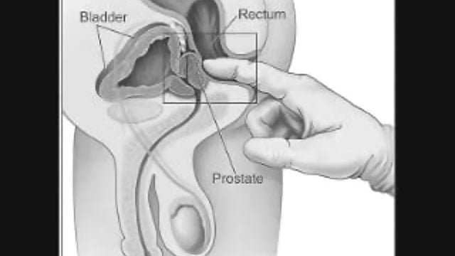 best of Prostate howto