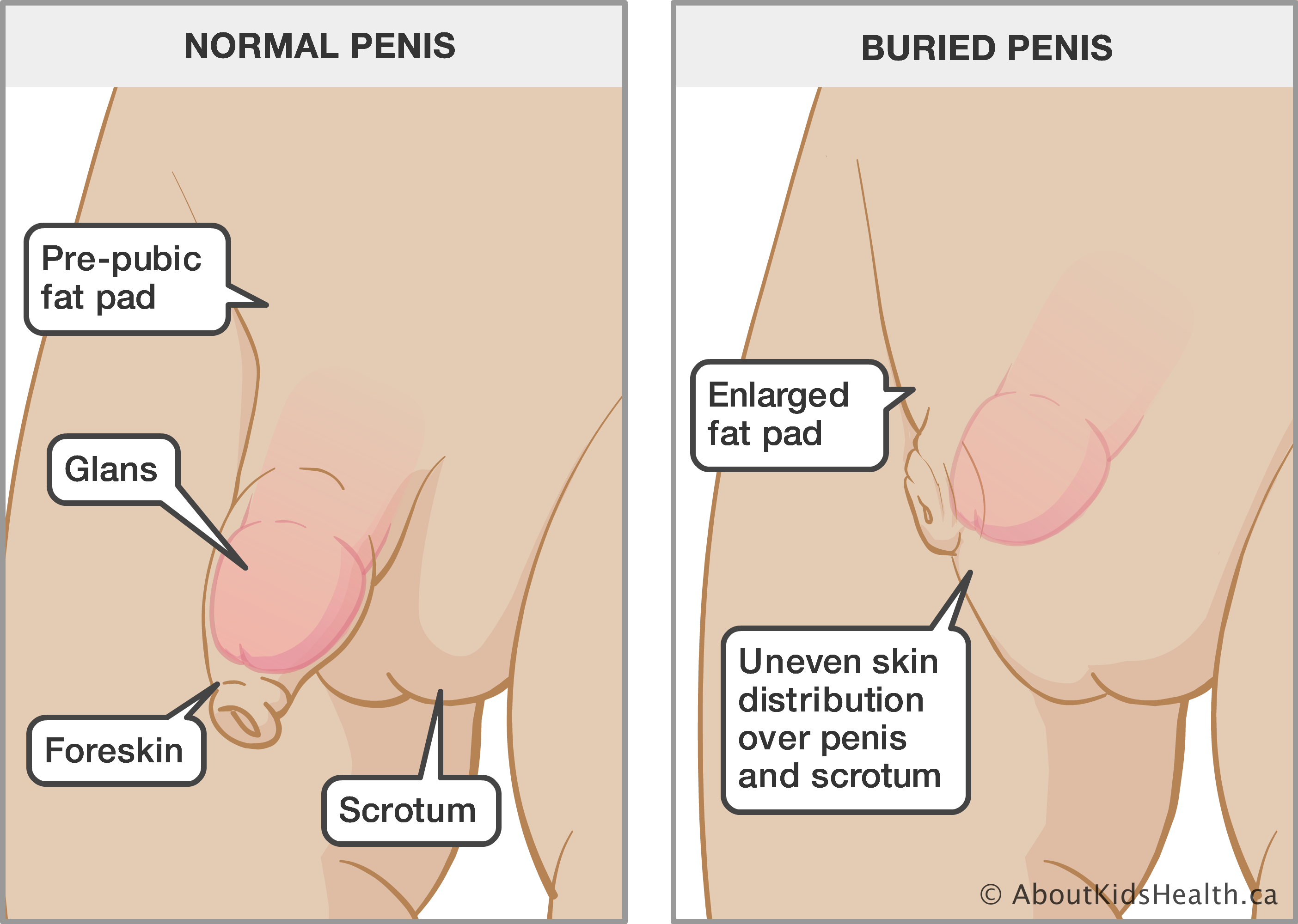 Did you know your penis can SHRINK? 