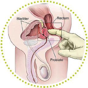 best of Prostate howto